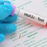 HbA1c: Memahami Pentingnya Tes Ini bagi Kesehatan Anda